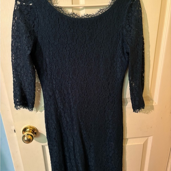 Aritzia babaton Rafael lace dress - Picture 2 of 2